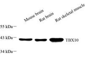 Western blot analysis of TBX10 (ABIN7075814),at dilution of 1: 1000,Lane 1: Mouse brain tissue lysate,Lane 2: Rat brain tissue lysate,Lane 3: Rat skeletal muscle tissue lysate