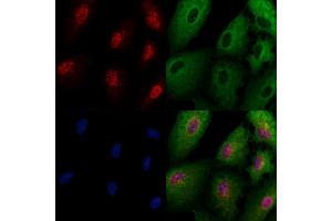 ABIN6262731 and ABIN6266953 staining  cells by IF/ICC. (TAF9 抗体  (Internal Region))