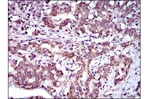 Immunohistochemistry (IHC) image for anti-ATP-Binding Cassette, Sub-Family G (WHITE), Member 5 (ABCG5) (AA 306-367) antibody (ABIN1724857)