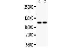Western Blotting (WB) image for anti-ATPase, Ca++ Transporting, Ubiquitous (ATP2A3) (AA 1-30), (N-Term) antibody (ABIN3043794) (ATP2A3 抗体  (N-Term))