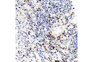 Immunohistochemistry of paraffin-embedded human appendix using P Rabbit mAb (ABIN7269154) at dilution of 1:100 (40x lens). (PAX5 抗体)