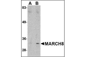 Western blot analysis of MARCH8 in HeLa cell lysate with MARCH8 antibody at (A) 0. (MARCH8 抗体  (C-Term))