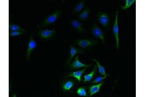 Immunofluorescence (IF) image for anti-Sodium Dependent Vitamin C Transporter 1 (SVCT1) (AA 173-259) antibody (ABIN7170170)