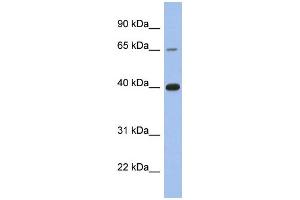 WB Suggested Anti-ESR1 Antibody Titration:  0. (Estrogen Receptor alpha 抗体  (C-Term))