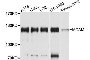 Western blot analysis of extracts of HeLa cells, using MCAM antibody. (MCAM 抗体  (AA 447-646))
