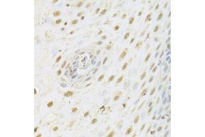 Immunohistochemistry of paraffin-embedded human esophagus using HDAC3 Antibody. (HDAC3 抗体  (AA 299-428))