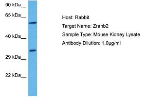 Host: Mouse Target Name: ZRANB2 Sample Tissue: Mouse Kidney Antibody Dilution: 1ug/ml (EIF5 抗体  (C-Term))