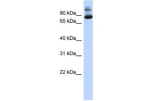 WB Suggested Anti-SIX4 Antibody Titration:  0. (SIX4 抗体  (N-Term))