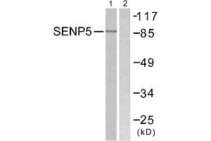 Western Blotting (WB) image for anti-SUMO1/sentrin Specific Peptidase 5 (SENP5) (C-Term) antibody (ABIN1848845) (SENP5 抗体  (C-Term))