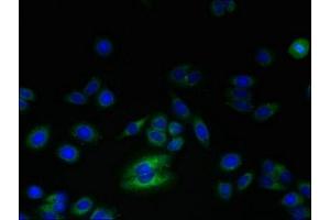 Immunofluorescent analysis of HepG2 cells using ABIN7168256 at dilution of 1:100 and Alexa Fluor 488-congugated AffiniPure Goat Anti-Rabbit IgG(H+L) (RNF24 抗体  (AA 45-148))