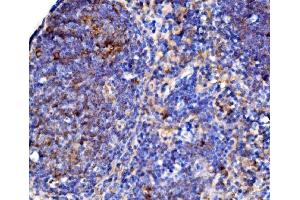 IHC analysis of Cd38 using anti-Cd38 antibody (ABIN7602864). (CD38 抗体  (C-Term))