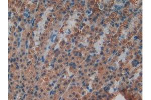 Detection of ND5 in Rat Stomach Tissue using Polyclonal Antibody to NADH Dehydrogenase 5 (ND5) (MT-ND5 抗体  (AA 425-562))