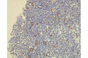 Immunohistochemistry (IHC) image for anti-CD163 (CD163) (AA 134-148), (N-Term) antibody (ABIN870408) (CD163 抗体  (N-Term))