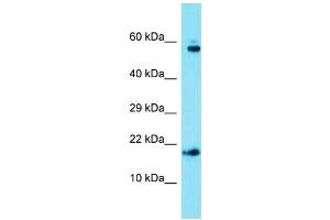 Host: Rabbit  Target Name: Ap1s1  Sample Tissue: Mouse Heart lysates  Antibody Dilution: 1. (AP1S1 抗体  (C-Term))