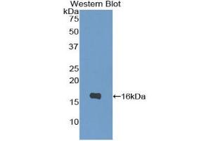 Western blot analysis of the recombinant protein. (IL-4 抗体  (AA 25-133))