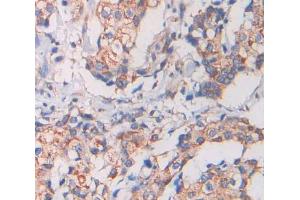 Used in DAB staining on fromalin fixed paraffin- embedded Kidney tissue (KEL 抗体  (AA 128-332))