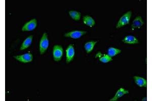 Immunofluorescent analysis of A549 cells using ABIN7146905 at dilution of 1:100 and Alexa Fluor 488-congugated AffiniPure Goat Anti-Rabbit IgG(H+L) (CARD10 抗体  (AA 863-1032))