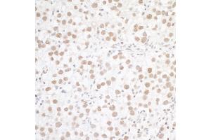 anti-Wilms Tumor 1 Associated Protein (WTAP) (AA 346-396) antibody