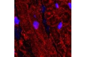 Immunohistochemistry (IHC) image for anti-Calcium Channel, Voltage-Dependent, L Type, alpha 1C Subunit (CACNA1C) (AA 848-865), (Intracellular) antibody (ABIN7043000)