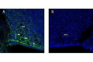 anti-Adiponectin Receptor 1 (ADIPOR1) (AA 18-31), (Intracellular), (N-Term) antibody