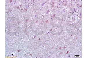 Formalin-fixed and paraffin embedded rat brain tissue labeled with Anti-Lingo-1 Polyclonal Antibody, Unconjugated (ABIN738801) at 1:200 followed by conjugation to the secondary antibody and DAB staining (LINGO1 抗体  (AA 521-620))