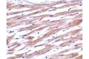 Immunohistochemistry of UNG1 in human heart tissue with this product at 2 μg/ml. (UNG 抗体  (C-Term))
