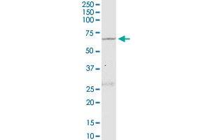 NLK monoclonal antibody (M02), clone 2B11. (Nemo-Like Kinase 抗体  (AA 416-515))
