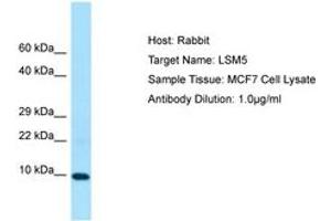 LSM5 抗体  (C-Term)