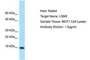 Image no. 1 for anti-LSM5 Homolog, U6 Small Nuclear RNA Associated (LSM5) (C-Term) antibody (ABIN6750056) (LSM5 抗体  (C-Term))
