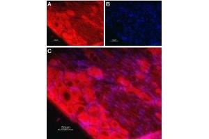 Immunohistochemistry (IHC) image for anti-Neurotrophic tyrosine Kinase, Receptor, Type 3 (NTRK3) (AA 393-405), (Extracellular) antibody (ABIN7043391)