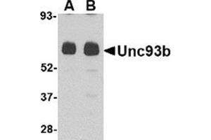 Western blot analysis of Unc93b in human heart tissue lysate with this product at (A) 0. (UNC93B1 抗体  (N-Term))
