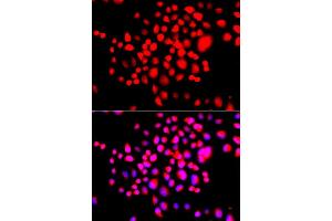Immunofluorescence analysis of A549 cell using STK19 antibody. (STK19 抗体)