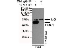 Immunoprecipitation analysis of Hela cell lysates using FEN-1 mouse mAb. (FEN1 抗体)