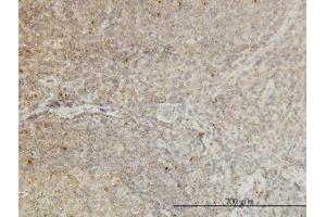 Image no. 1 for anti-Cyclin-Dependent Kinase-Like 4 (CDKL4) (AA 196-295) antibody (ABIN466282) (CDKL4 抗体  (AA 196-295))