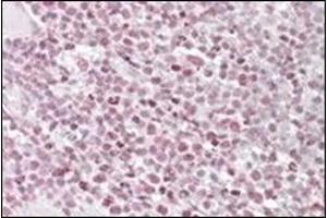 Staining of paraffin embedded Human Tonsil using IKAROS antibody at 1 µg/ml. (IKZF1 抗体  (Internal Region))