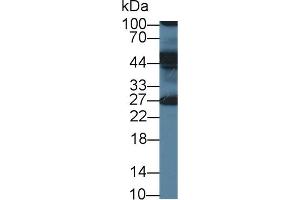 Detection of ERLIN2 in Human Milk using Polyclonal Antibody to Endoplasmic Reticulum Lipid Raft Associated Protein 2 (ERLIN2) (ERLIN2 抗体  (AA 47-339))