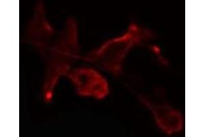ABIN6275464 staining Hela cells by IF/ICC. (RAB2B 抗体  (Internal Region))