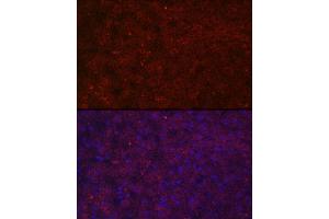 Immunofluorescence analysis of human liver cells using LRG1 Rabbit pAb (ABIN6130528, ABIN6143317, ABIN6143318 and ABIN6223826) at dilution of 1:100 (40x lens). (LRG1 抗体  (AA 36-347))