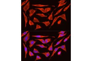Immunofluorescence analysis of HeLa cells using POMC Rabbit pAb (ABIN3017230, ABIN3017231, ABIN3017232 and ABIN6220004) at dilution of 1:200 (40x lens). (POMC 抗体  (AA 1-267))