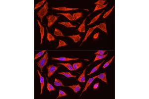Immunofluorescence analysis of HeLa cells using POMC Rabbit pAb (ABIN3017230, ABIN3017231, ABIN3017232 and ABIN6220004) at dilution of 1:200 (40x lens). (POMC 抗体  (AA 1-267))