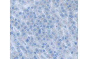 Used in DAB staining on fromalin fixed paraffin- embedded liver tissue (ABCG8 抗体  (AA 1-271))