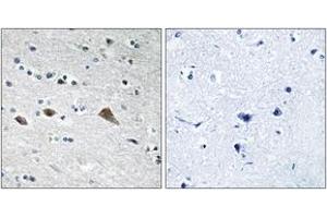 Immunohistochemistry analysis of paraffin-embedded human brain tissue, using BCAR3 Antibody. (BCAR3 抗体  (AA 761-810))