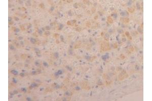 Detection of CLCF1 in Human Liver Tissue using Polyclonal Antibody to Cardiotrophin Like Cytokine Factor 1 (CLCF1) (CLCF1 抗体  (AA 88-190))