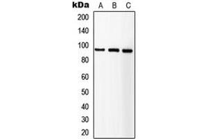 Western blot analysis of IGF1 Receptor expression in HEK293T (A), SP2/0 (B), NIH3T3 (C) whole cell lysates. (IGF1R 抗体  (C-Term))