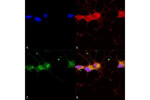 Immunocytochemistry (ICC) image for anti-Glutamate Receptor, Ionotropic, N-Methyl D-Aspartate 2B (GRIN2B) (AA 20-271) antibody (Biotin) (ABIN2483216)