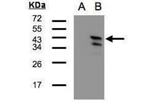 WB Image Western Blot analysis of CAMK1D expression in transfected 293T cell line by CAMK1D polyclonal antibody. (CAMK1D 抗体)