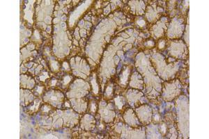 Immunohistochemistry (Paraffin-embedded Sections) (IHC (p)) image for anti-Solute Carrier Family 2 (Facilitated Glucose Transporter), Member 1 (SLC2A1) antibody (ABIN5997112)