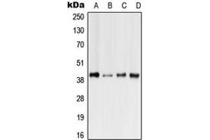 Western blot analysis of GPR41 expression in HeLa (A), Raw264. (FFAR3 抗体  (N-Term))