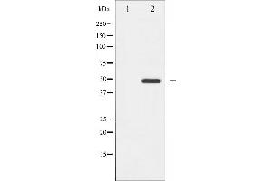 Western blot analysis of GATA4 expression in HeLa whole cell lysates,The lane on the left is treated with the antigen-specific peptide. (GATA4 抗体  (Internal Region))