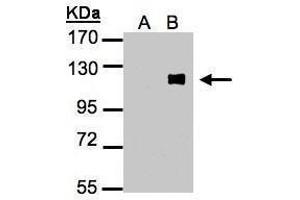 WB Image Western Blot analysis of ZNF281 expression in transfected 293T cell line by ZNF281 polyclonal antibody. (ZNF281 抗体)